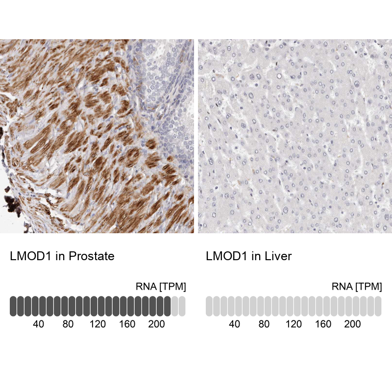 <b>Independent Antibodies Validation and Orthogonal Strategies Validation.</b>Analysis in human prostate and liver tissues. Corresponding LMOD1 RNA-seq data are presented for the same tissues.