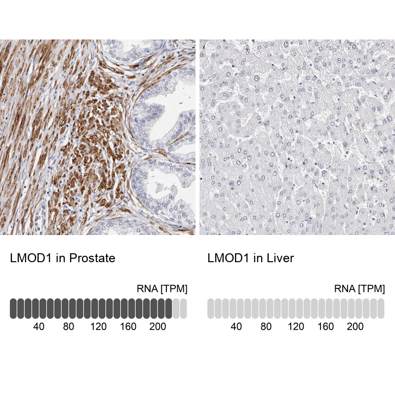 <b>Independent Antibodies Validation and Orthogonal Strategies Validation.</b>Analysis in human prostate and liver tissues using NBP1-89398 antibody. Corresponding LMOD1 RNA-seq data are presented for the same tissues.