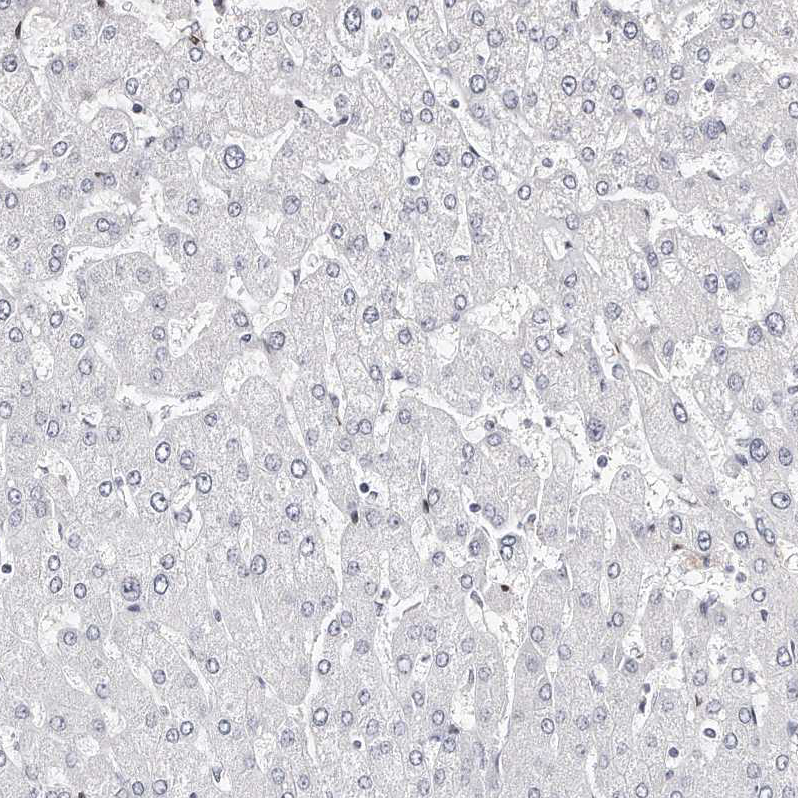 Staining of human liver shows no positivity in hepatocytes as expected.