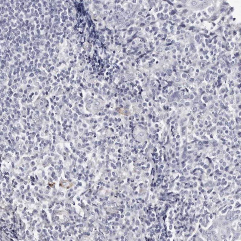 Staining of human tonsil shows no positivity in non-germinal center cells as expected.