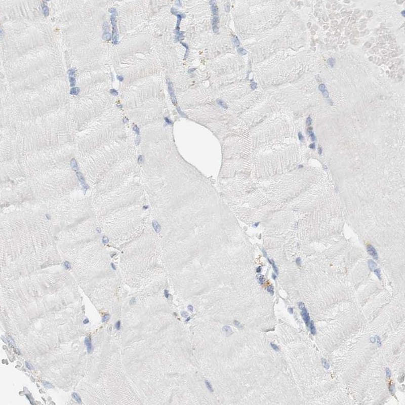 Immunohistochemistry-Paraffin ALOX12B Antibody - BSA Free