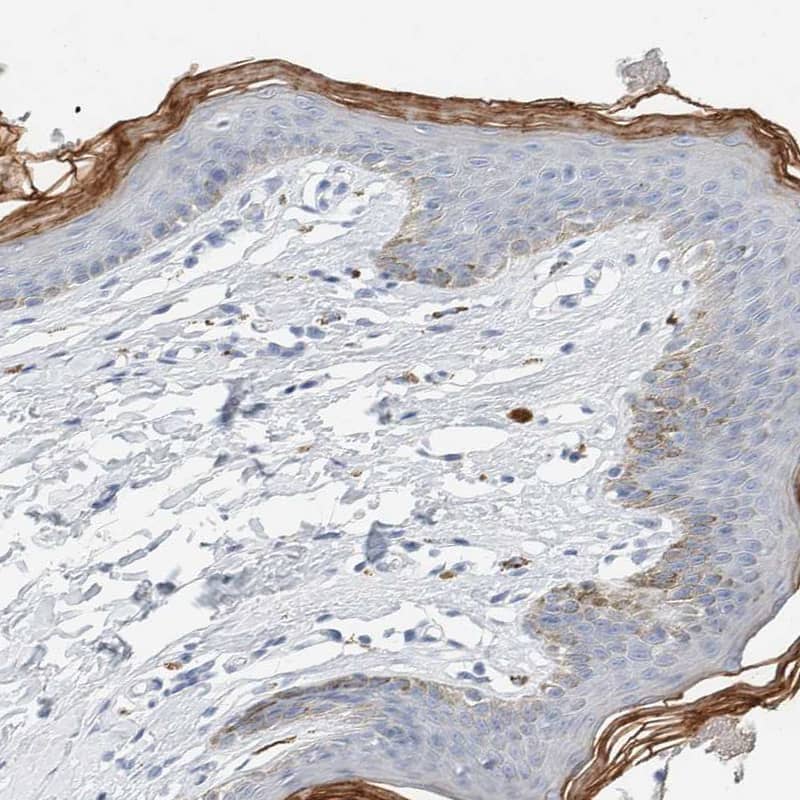 Immunohistochemistry-Paraffin ALOX12B Antibody - BSA Free