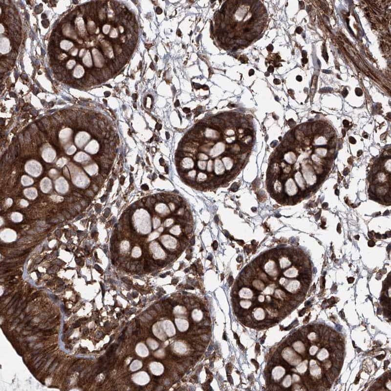 Staining of human colon shows strong cytoplasmic positivity in glandular cells.