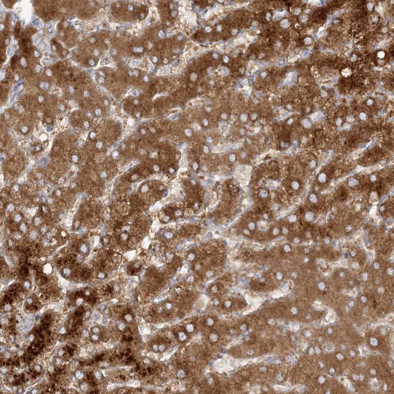 Staining of human liver shows strong cytoplasmic positivity in hepatocytes.