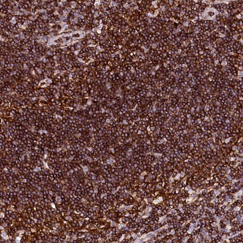 Staining of human lymph node shows strong cytoplasmic positivity in non-germinal center cells.