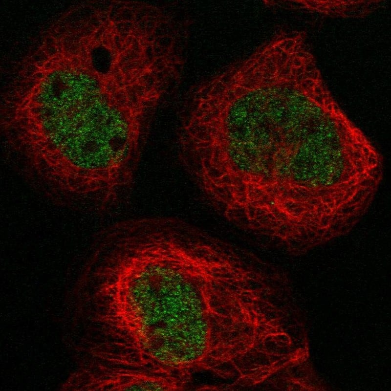 Staining of human cell line A-431 shows localization to nucleoplasm.