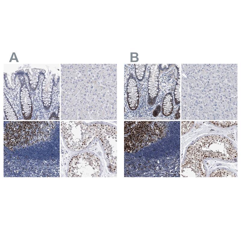Staining of human colon, liver, lymph node and testis using NBP1-89434 (A) shows similar protein distribution across tissues to independent antibody NBP1-89504 (B).