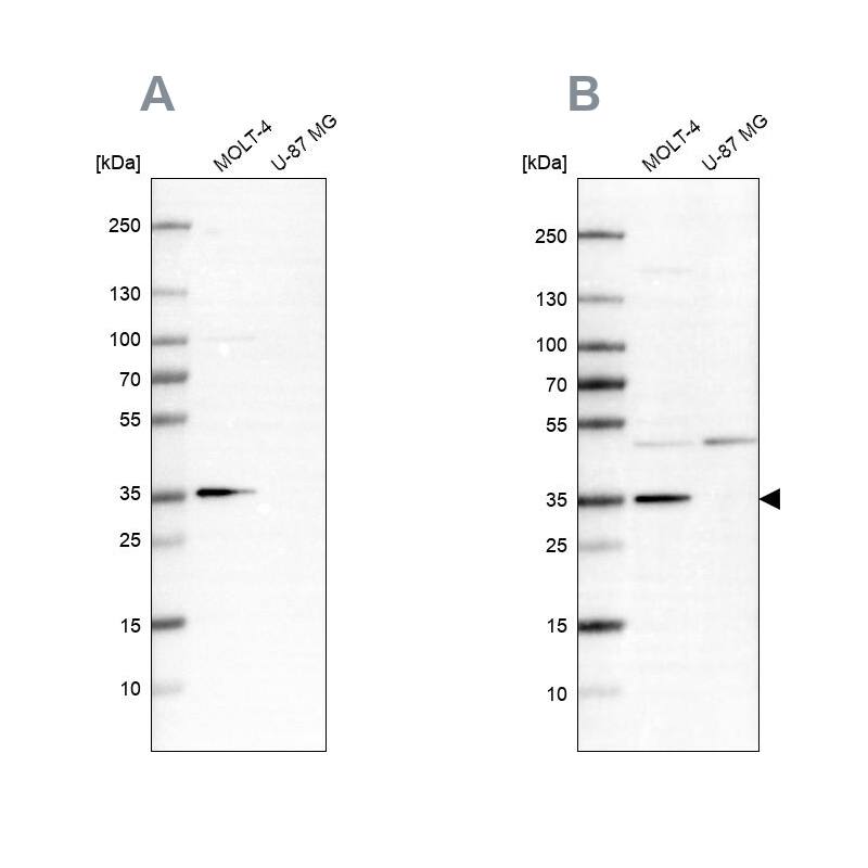 Analysis using NBP1-89434 (A) shows similar pattern to independent antibody NBP1-89504 (B).