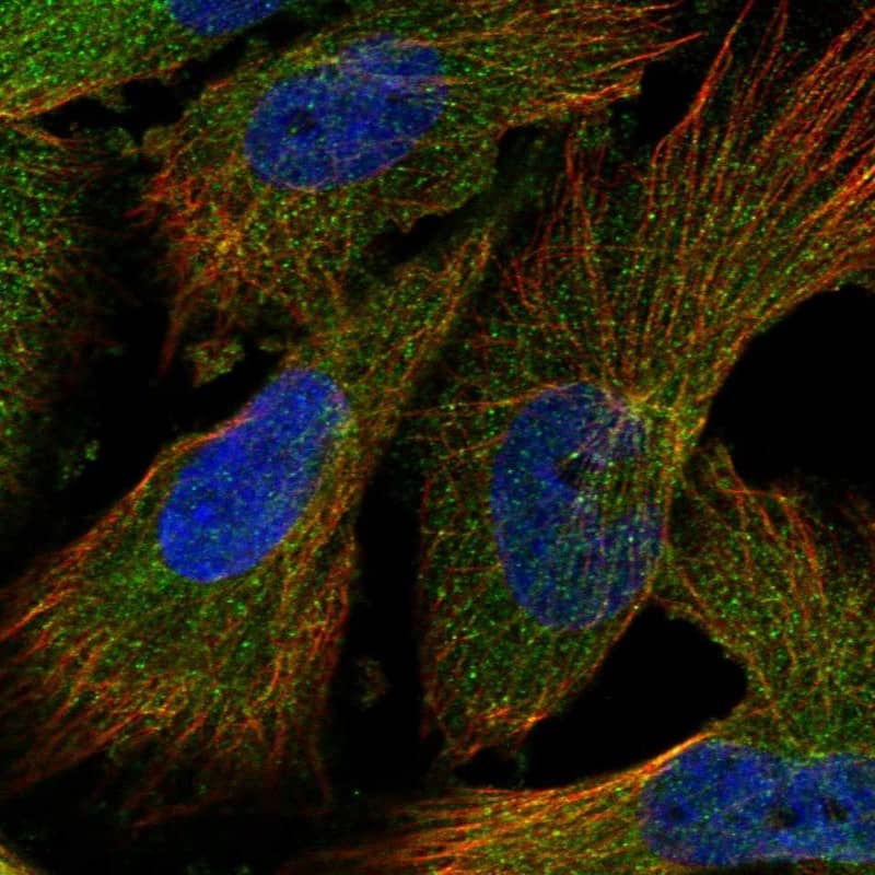 Staining of human cell line U-251 MG shows localization to cytosol.