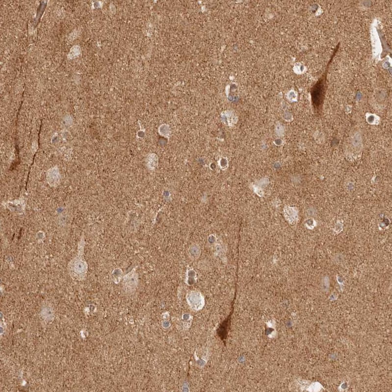 Staining of human cerebral cortex shows moderate positivity in neuropil.