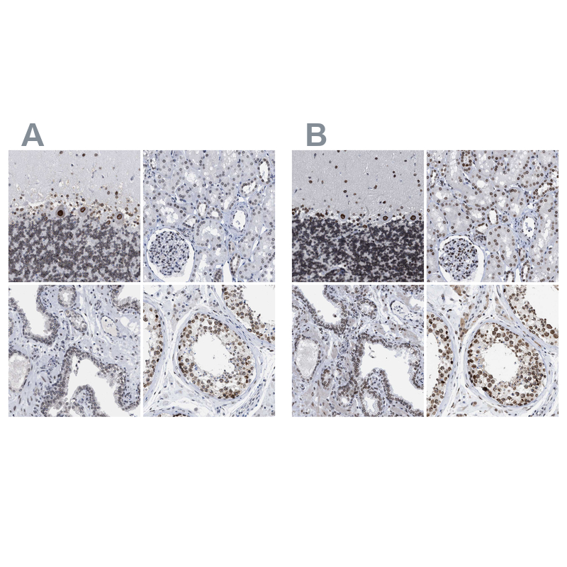 <b>Independent Antibodies Validation. </b>Staining of human cerebellum, kidney, prostate and testis using Anti-TPR antibody NBP1-89451 (A) shows similar protein distribution across tissues to independent antibody NBP1-89452 (B).