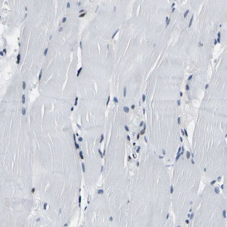 Staining of human skeletal muscle shows weak nuclear positivity in myocytes.