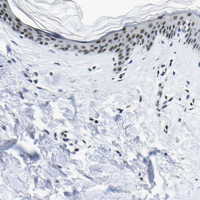 Staining of human skin shows moderate nuclear positivity in squamous epithelial cells.