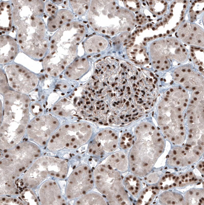 Staining of human kidney shows strong nuclear positivity in cells in glomeruli.
