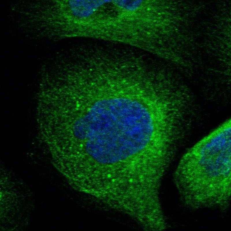 Staining of human cell line A-431 shows localization to microtubules & vesicles.