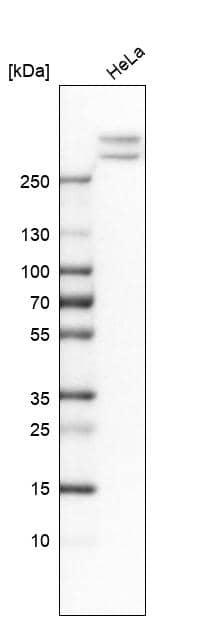 Analysis in human cell line HeLa.