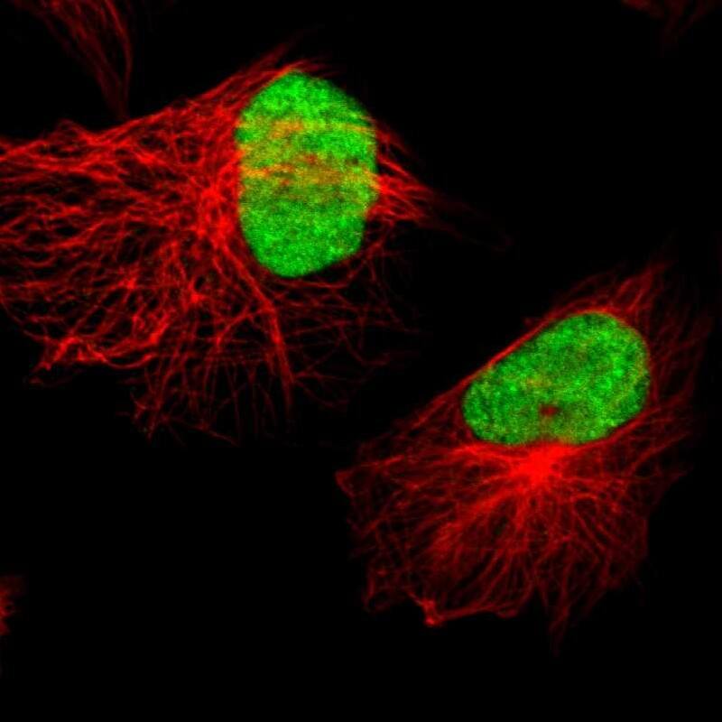 Staining of human cell line U-251 MG shows localization to nucleus.