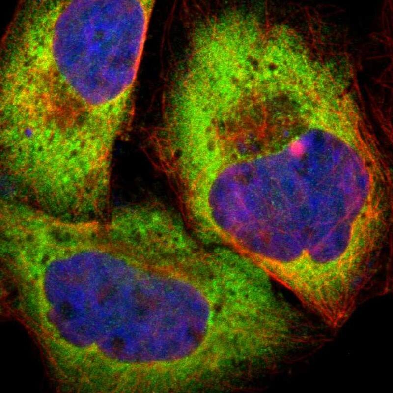 Staining of human cell line A-431 shows localization to cytosol.