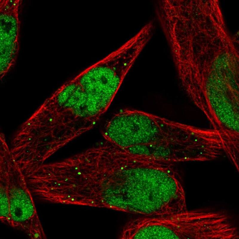 Immunocytochemistry/ Immunofluorescence MEF2C Antibody - BSA Free