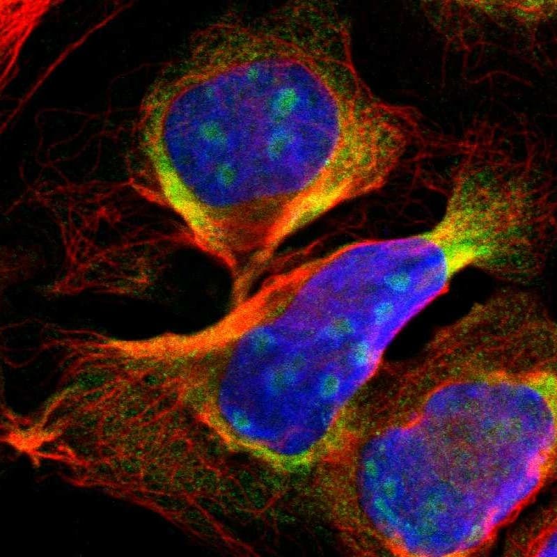 Staining of human cell line U-2 OS shows positivity in nucleoli & cytoplasm.