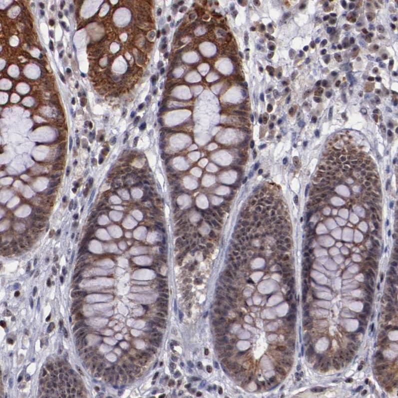 Staining of human rectum shows moderate positivity in nucleoli and cytoplasm in glandular cells.