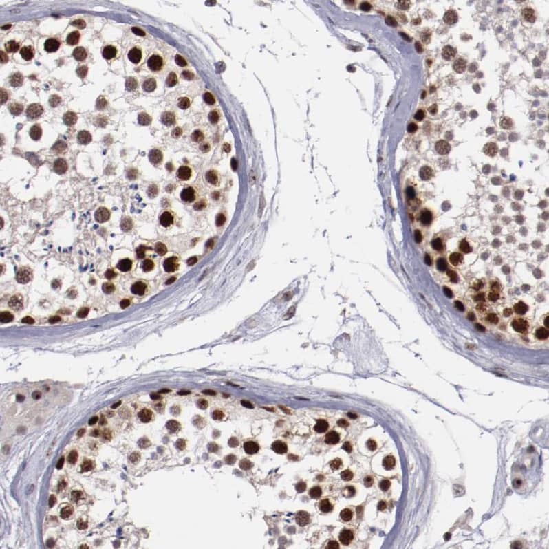 Staining of human testis shows strong nuclear positivity in cells in seminiferous ducts.