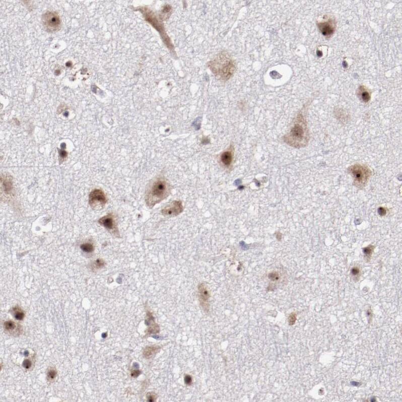 Staining of human cerebral cortex shows strong nuclear positivity in neurons.