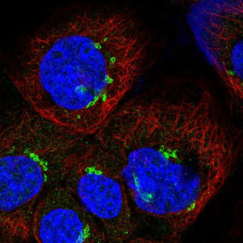 Staining of human cell line A-431 shows localization to the Golgi apparatus.