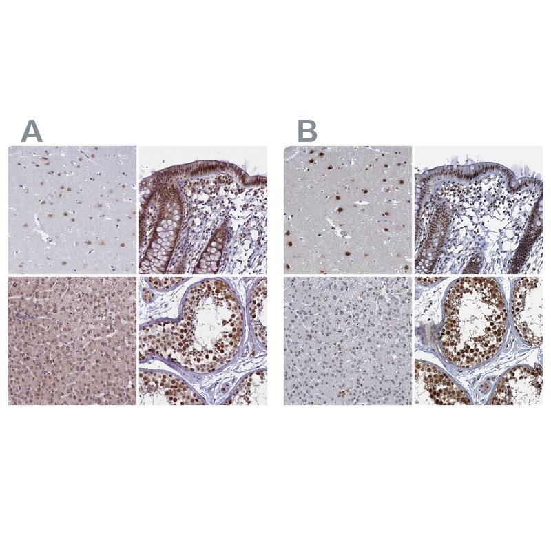 Immunohistochemistry-Paraffin PPHLN1 Antibody - BSA Free