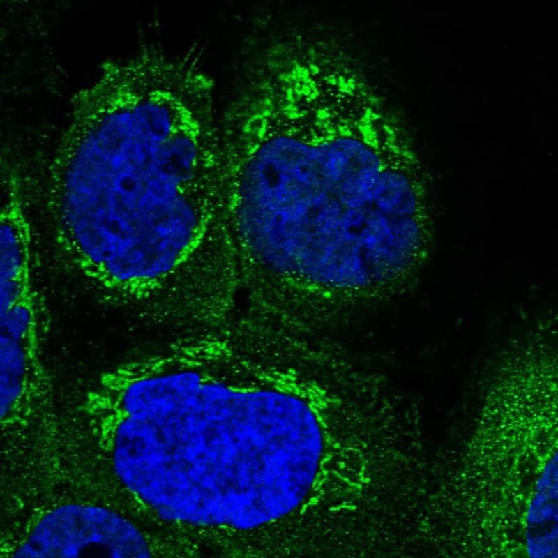 Staining of human cell line A-431 shows localization to plasma membrane & mitochondria.