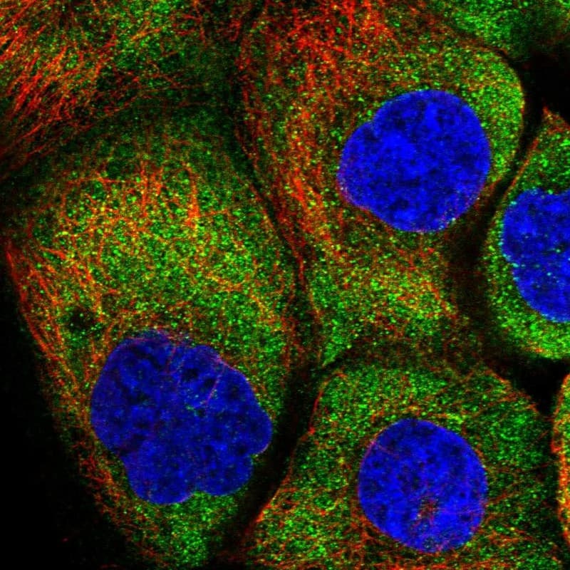 Staining of human cell line A-431 shows localization to cytosol.
