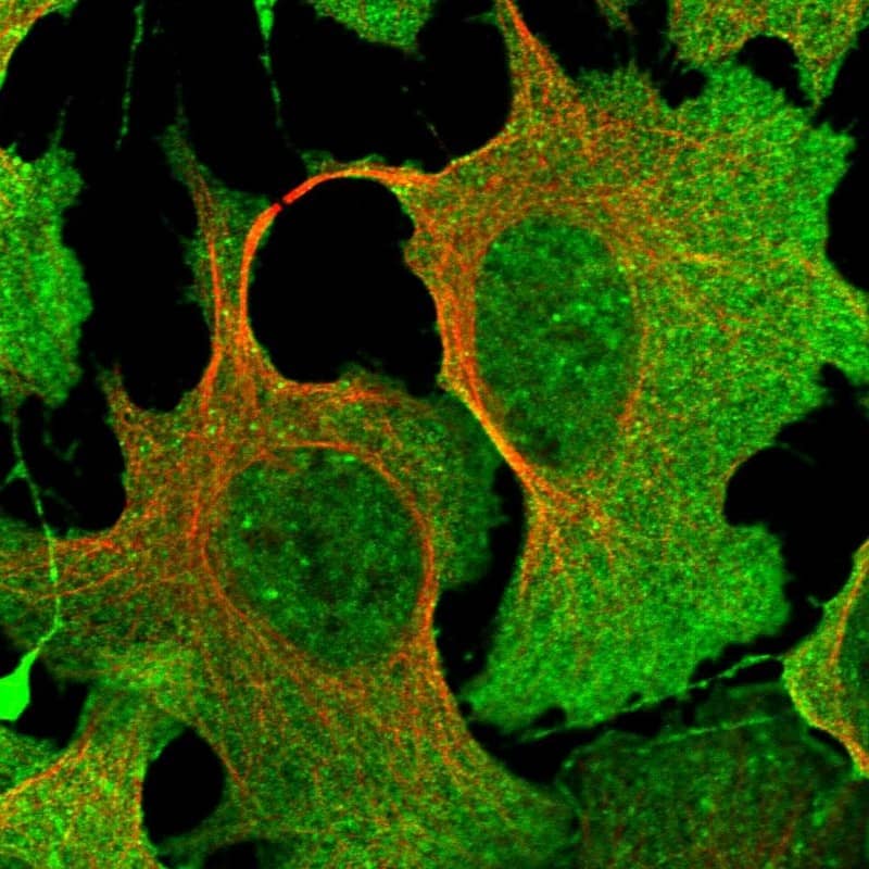 Staining of human cell line U-2 OS shows localization to nuclear speckles, plasma membrane & cytosol.