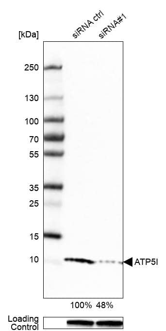<b>Genetic Strategies Validation. </b>Analysis in U-251MG cells transfected with control siRNA, target specific siRNA probe #1, using Anti-ATP5I antibody. Remaining relative intensity is presented. Loading control: Anti-GAPDH.