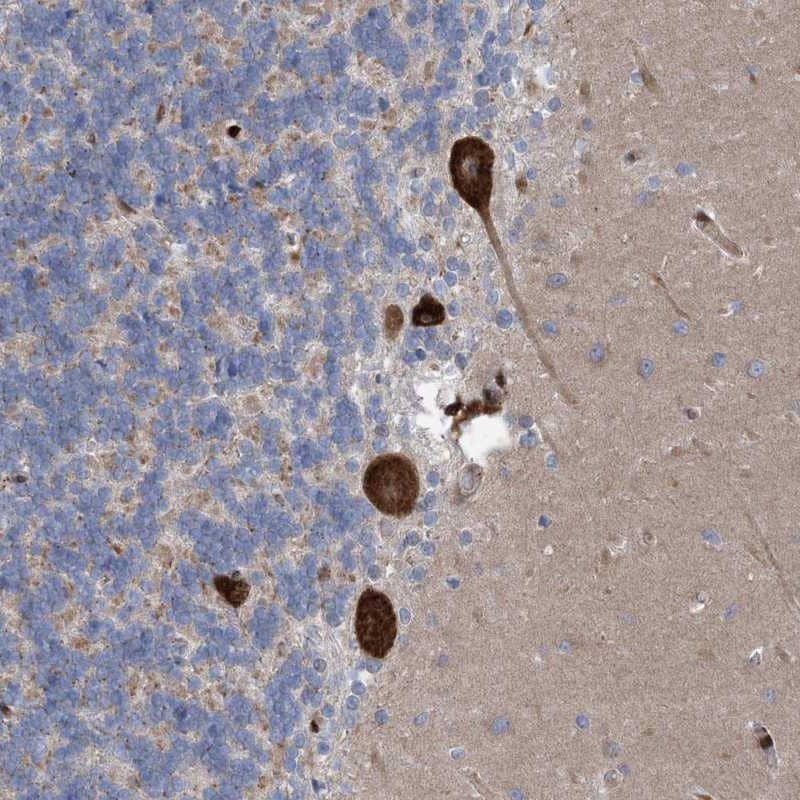 Immunohistochemistry-Paraffin RBMS3 Antibody - BSA Free