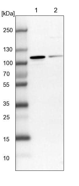 Lane 1: NIH-3T3 cell lysate (Mouse embryonic fibroblast cells)Lane 2: NBT-II cell lysate (Rat Wistar bladder tumour cells)