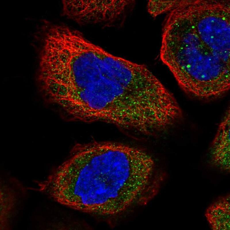 Staining of human cell line A-431 shows localization to cytosol.