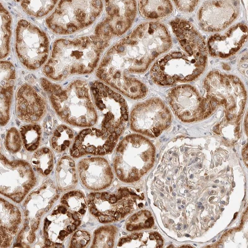 Staining of human kidney shows strong cytoplasmic positivity in cells in tubules.