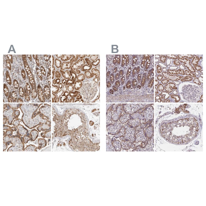 Staining of human gastrointestinal, kidney, placenta and testis using Anti-DYRK4 antibody NBP1-89511 (A) shows similar protein distribution across tissues to independent antibody NBP2-38781 (B).