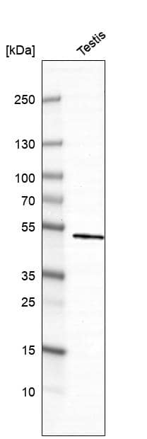 Analysis in human testis tissue.