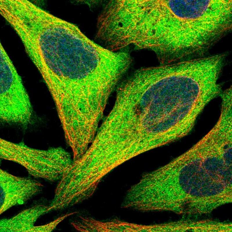 Staining of human cell line U-2 OS shows localization to cytosol.