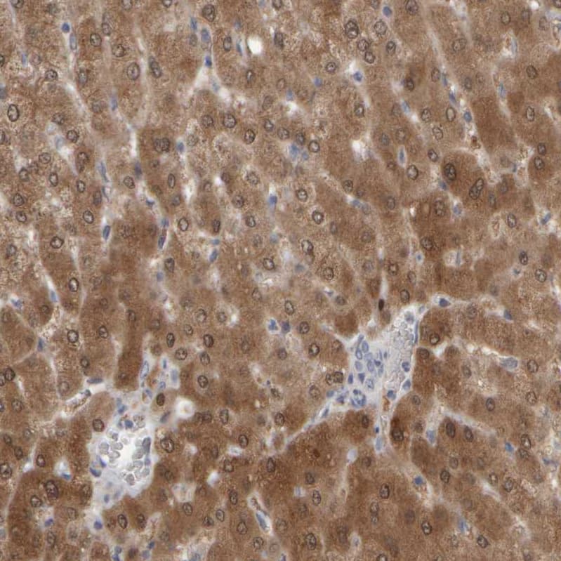 Staining of human liver shows moderate to strong cytoplasmic positivity in hepatocytes.