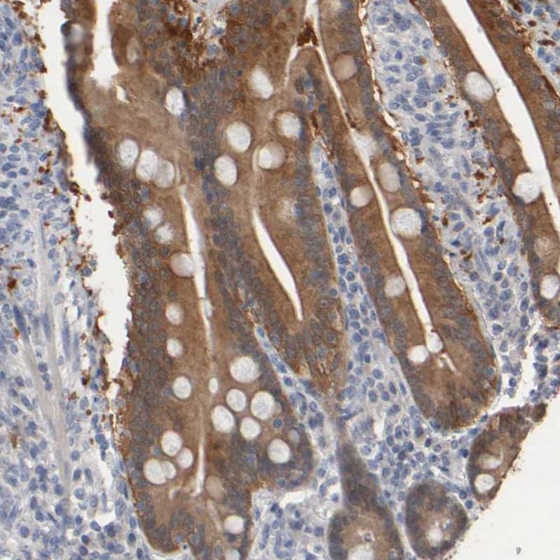 Staining of human duodenum shows moderate cytoplasmic positivity in glandular cells.