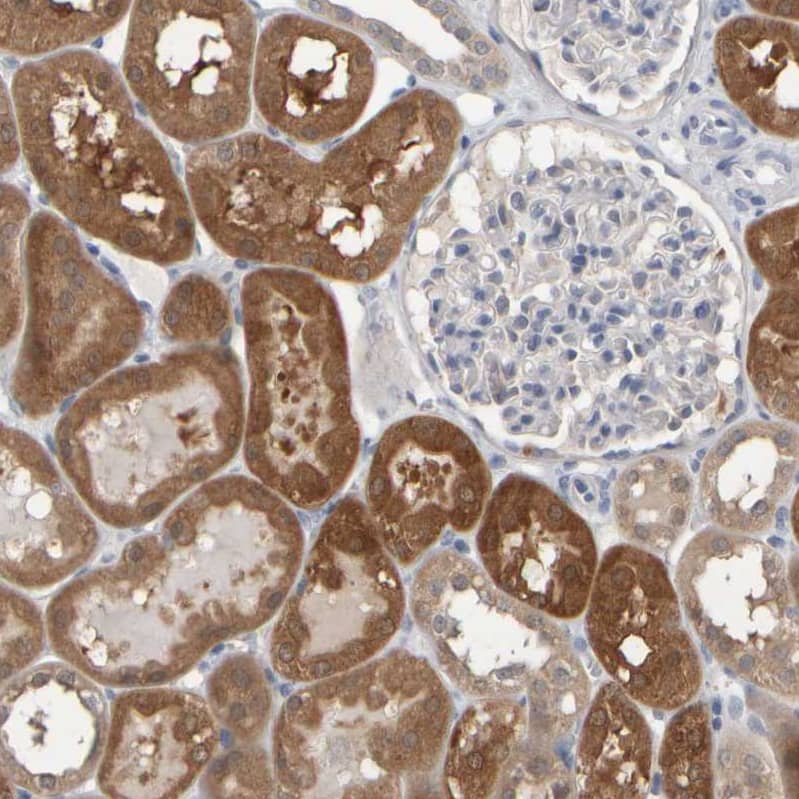 Staining of human kidney shows moderate to strong cytoplasmic positivity in cells in tubules.
