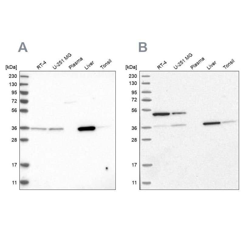 Western Blot CRYZ Antibody - BSA Free