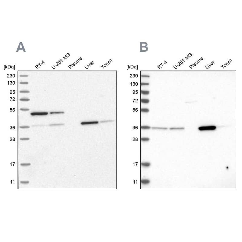Analysis using Anti-CRYZ antibody NBP1-89536 (A) shows similar pattern to independent antibody NBP1-89533 (B).