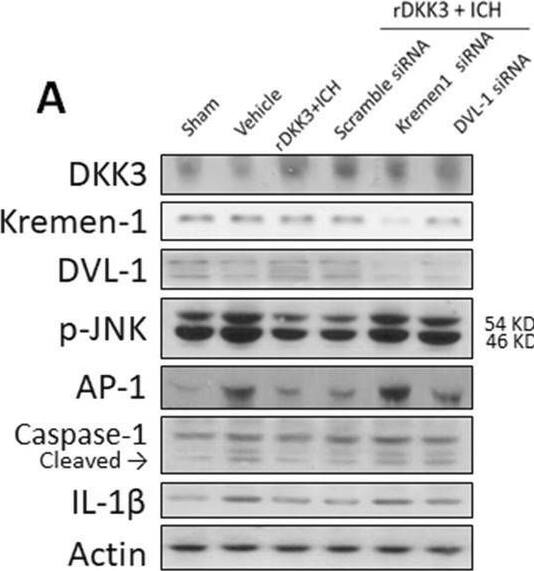 Western blot of rDKK3/Kremen-1/DVL-1 mechanistic pathway. Representative western blot bands (a) and the densitometric quantification of DKK3 (b), Kremen-1 (c), DVL-1 (d), p-JNK (e), AP-1 (F), cleaved caspase-1 (g), and IL-1 beta  (h) in the sham, vehicle, rDKK3, rDKK3 + scrambled siRNA, rDKK3 + Kremen-1 siRNA, and rDKK3 + DVL-1 siRNA groups 24 h after ICH. Data are expressed as the mean +/- SD. *p < 0.05 versus sham; #p < 0.05 versus vehicle; @p < 0.05 vs rDKK3 + scramble siRNA group, n = 6 animals per group Image collected and cropped by CiteAb from the following open publication (//pubmed.ncbi.nlm.nih.gov/32331523), licensed under a CC-BY license. Not internally tested by Novus Biologicals.
