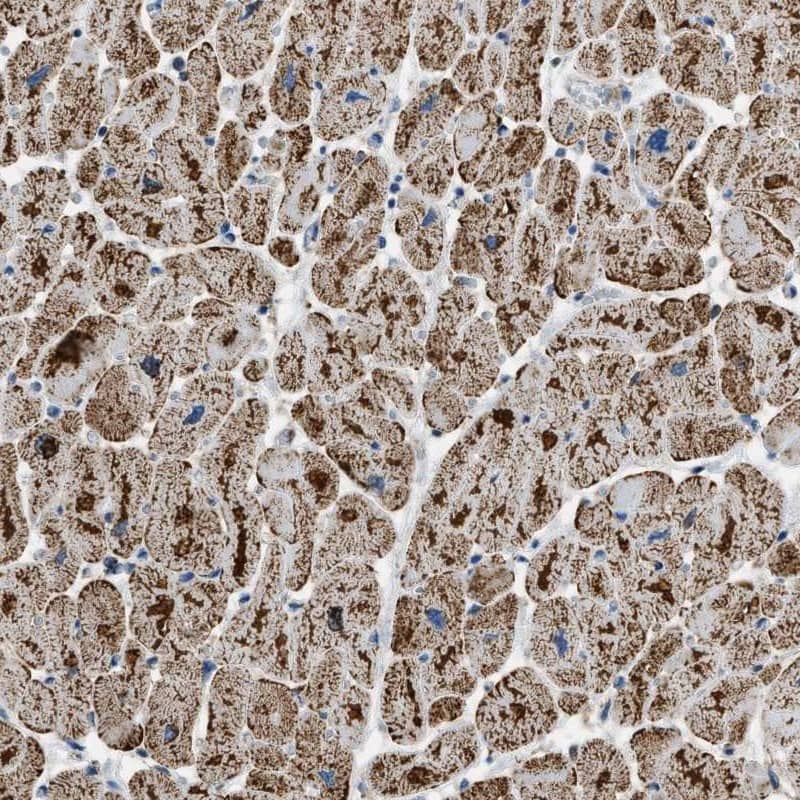 Staining of human heart muscle shows cytoplasmic positivity with a granular pattern in myocytes.