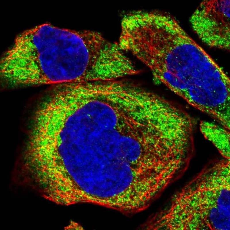 Staining of human cell line A-431 shows localization to cytosol.