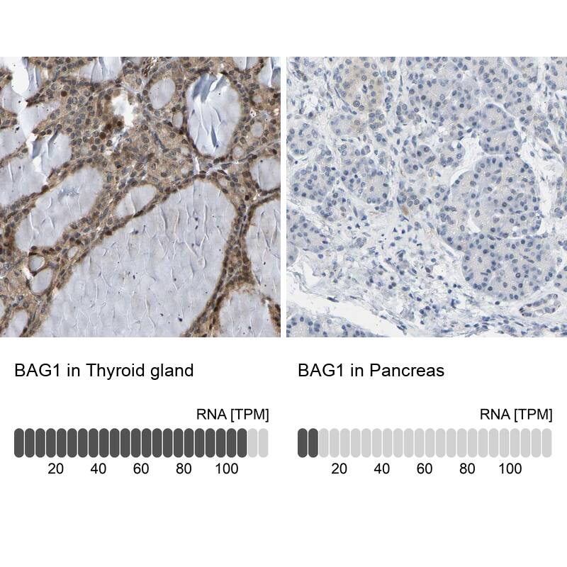 Analysis in human thyroid gland and pancreas tissues using Anti-BAG1 antibody. Corresponding BAG1 RNA-seq data are presented for the same tissues.