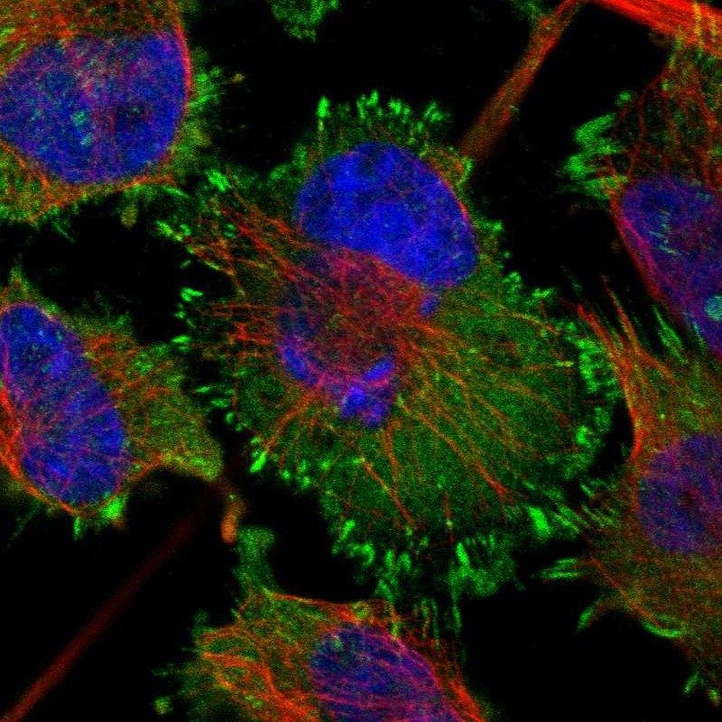Staining of human cell line U-251 MG shows localization to cytosol & focal adhesion sites.